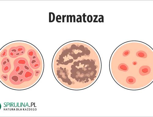 Dermatoza