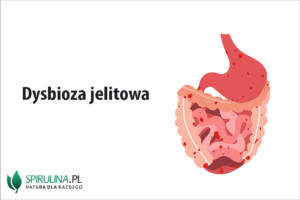 Dysbioza jelitowa