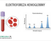 Elektroforeza hemoglobiny