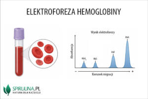 Elektroforeza hemoglobiny
