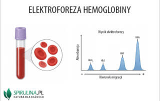 Elektroforeza hemoglobiny