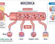 Mocznica