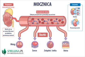 Mocznica