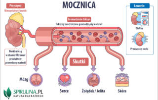 Mocznica