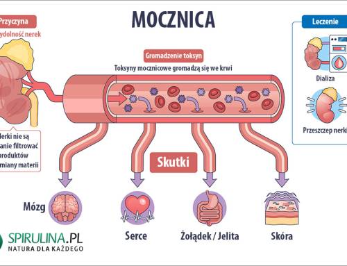 Mocznica