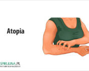 Atopia