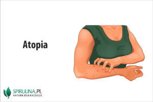 Atopia