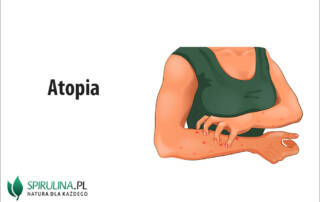 Atopia