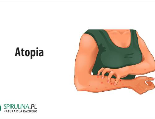 Atopia