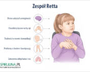 Zespół Retta