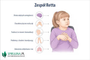 Zespół Retta