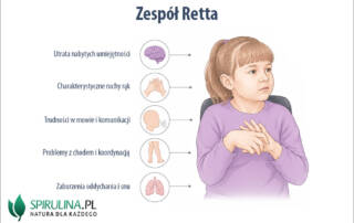 Zespół Retta