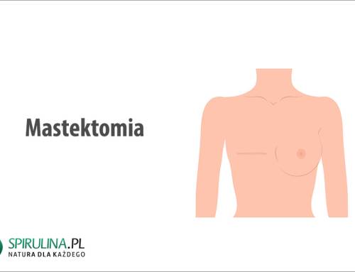 Mastektomia