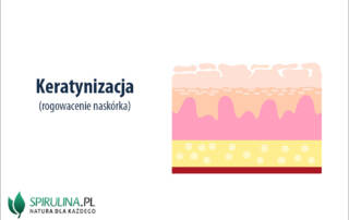 Keratynizacja