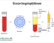 Osocze bogatopłytkowe