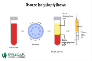 Osocze bogatopłytkowe