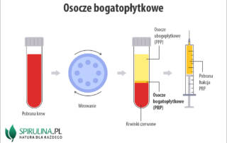 Osocze bogatopłytkowe