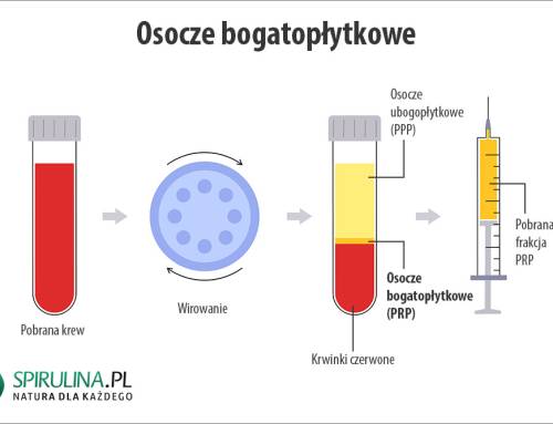 Osocze bogatopłytkowe