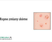 Ropne zmiany skórne