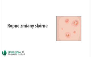 Ropne zmiany skórne