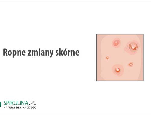 Ropne zmiany skórne