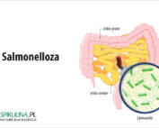 Salmonelloza