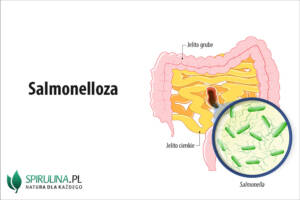 Salmonelloza
