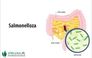 Salmonelloza