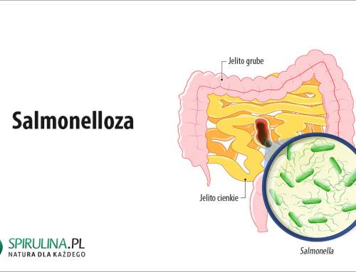 Salmonelloza