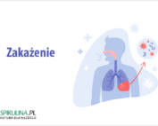 Zakażenie