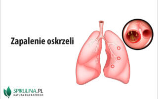 Zapalenie oskrzeli