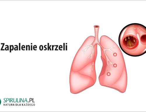 Zapalenie oskrzeli